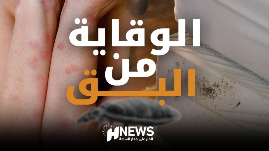 أخصائيون.. تهوية البيوت وتعريض الأفرشة للشمس يقي من البق