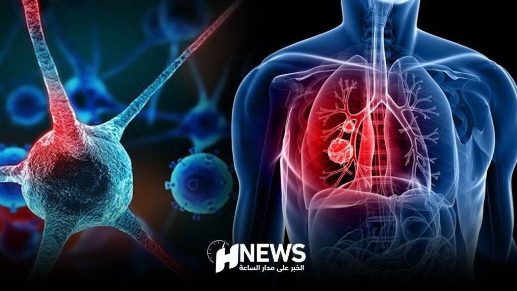 سرطان الرئة | H-NEWS آش نيوز سرطان الرئة