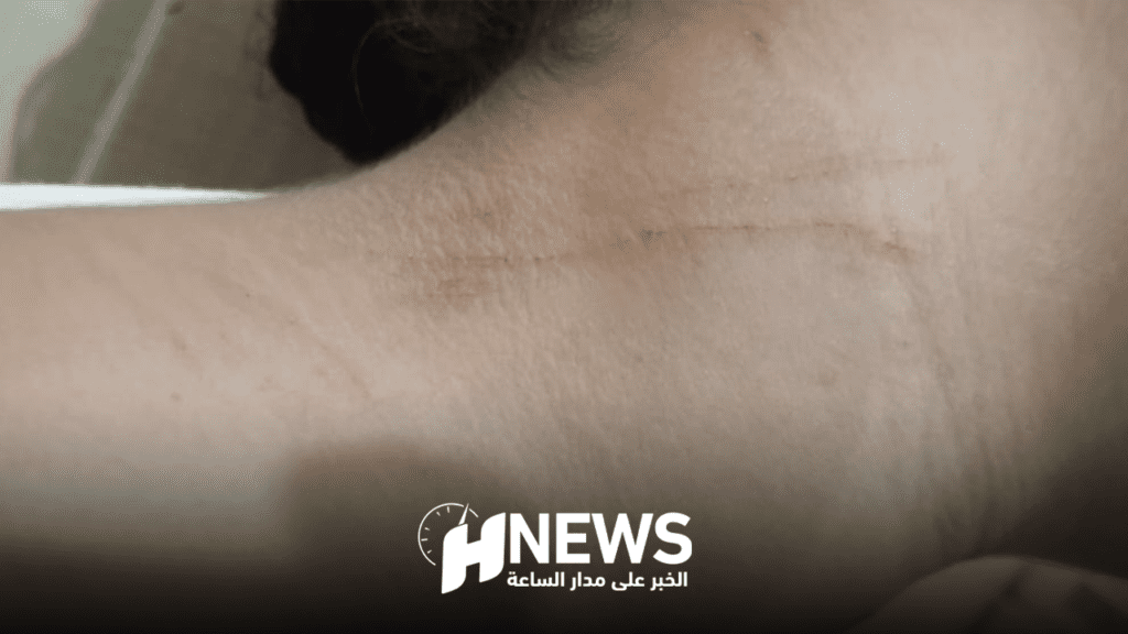 العيون ..أب قاصر عنفها أستاذها يستغيث ويكشف معاناة ابنته