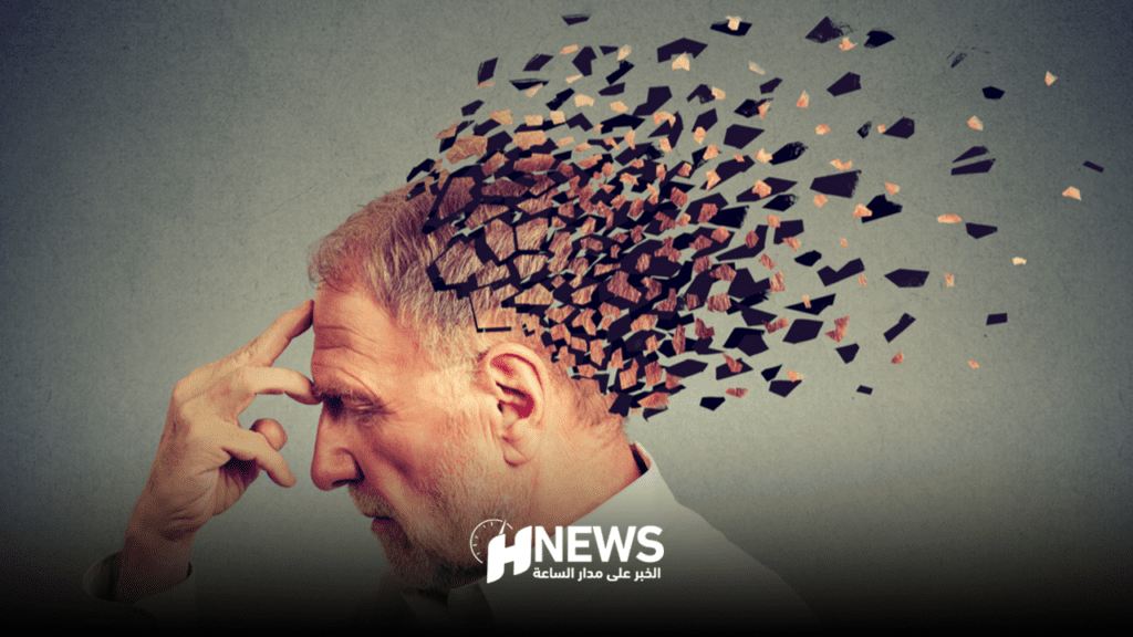 باحثون يوظفون الذكاء الاصطناعي للتنبؤ بالإصابة بالزهايمر