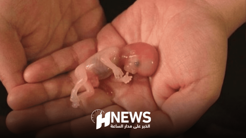 الاجهاض | H-NEWS آش نيوز