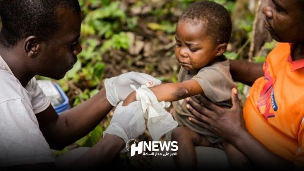 جدري القردة افريقيا | H-NEWS آش نيوز جدري القردة افريقيا