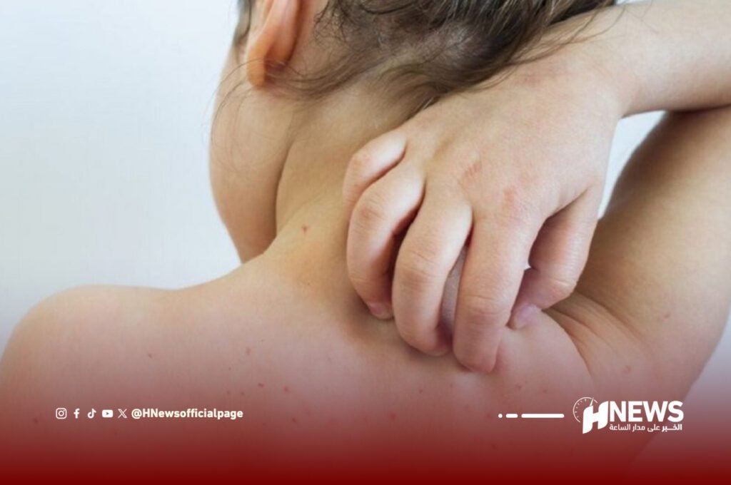 بوحمرون | H-NEWS آش نيوز بوحمرون