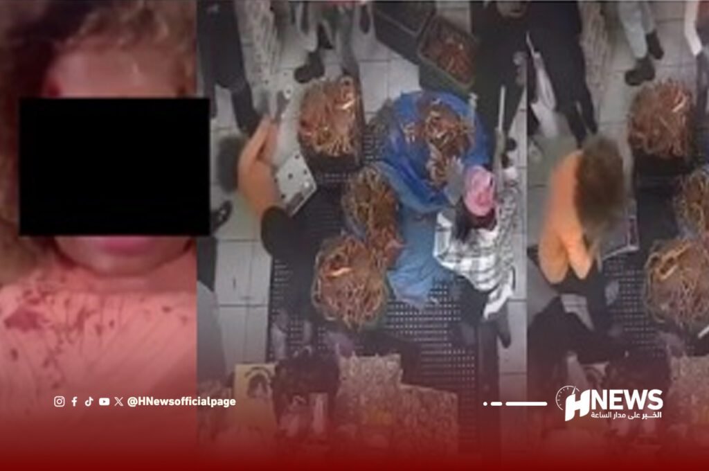 الشرطة تحقق في اعتداء جسدي على سيدة بسوق للأسماك بالبيضاء