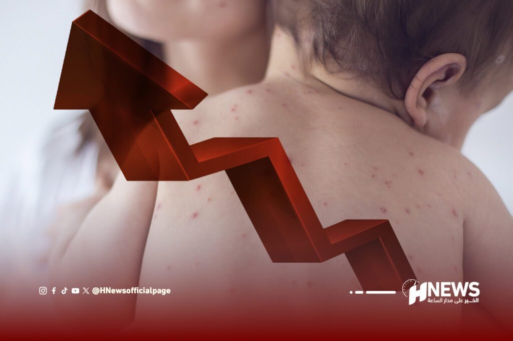 مرض بوحمرون | H-NEWS آش نيوز مرض بوحمرون