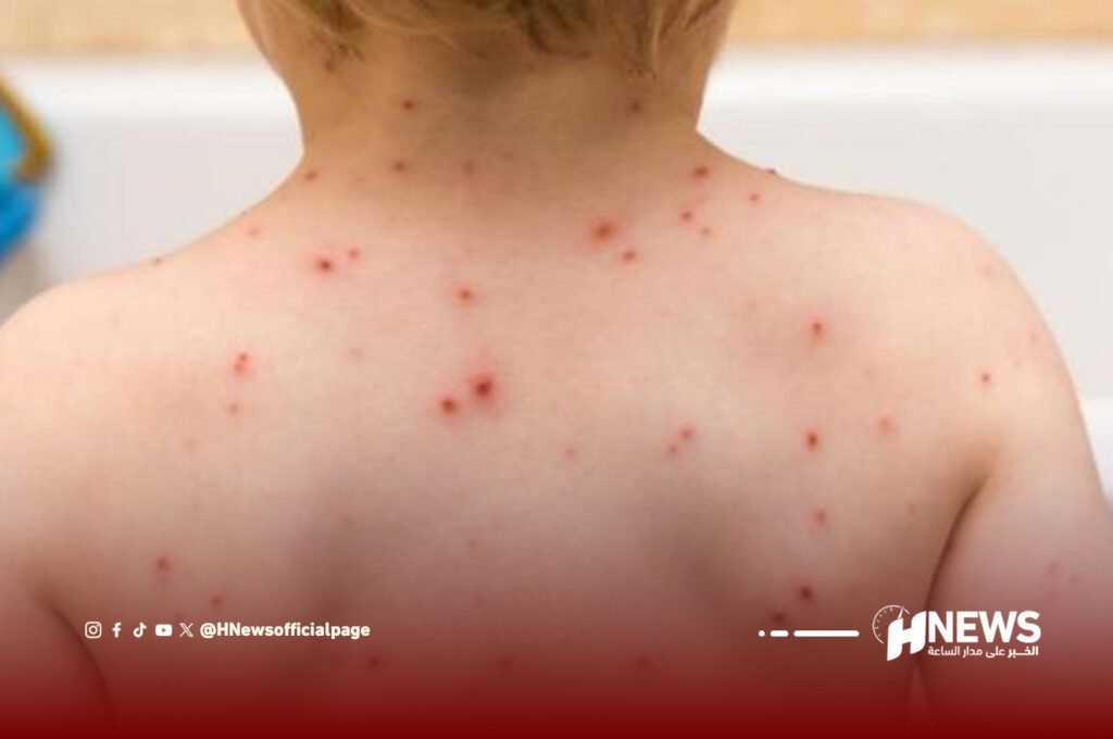 بوحمرون | H-NEWS آش نيوز بوحمرون