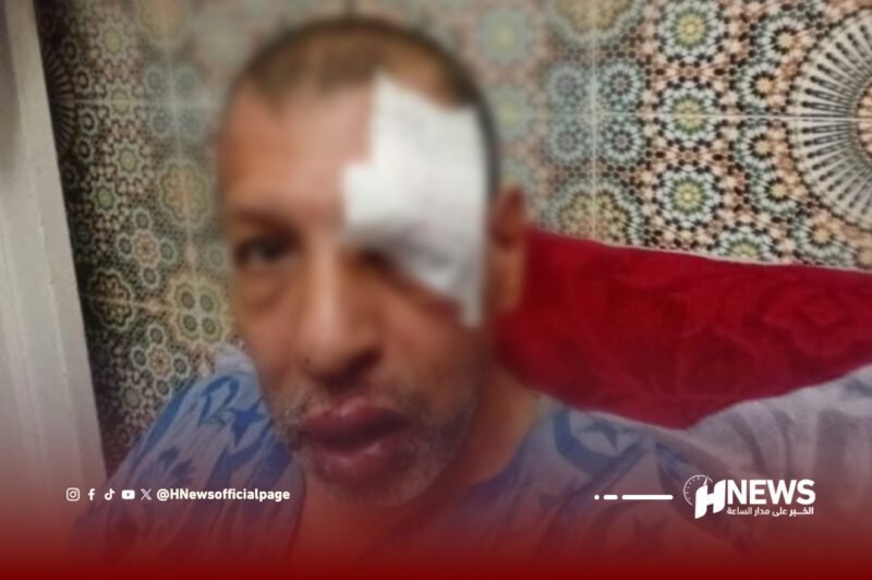 اعتداء أجنبي