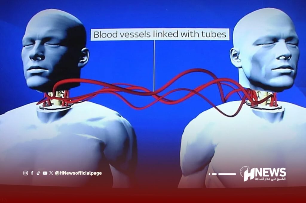 عملية نادرة تنقذ مريضا من انفصال الرأس عن الرقبة