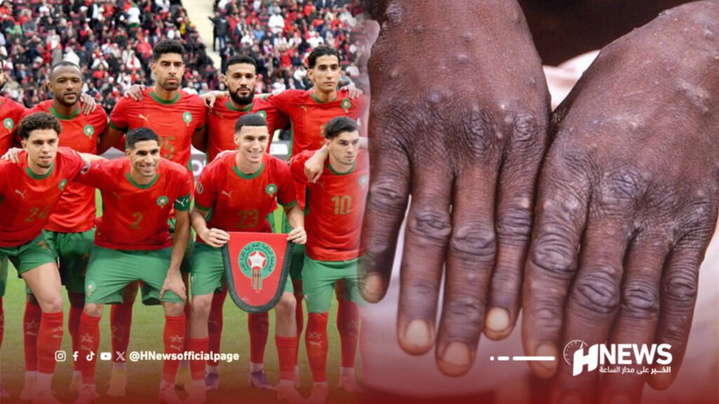جدري القردة يربك حسابات الأسود قبل رحلة جنوب إفريقيا لمواجهة ليسوتو