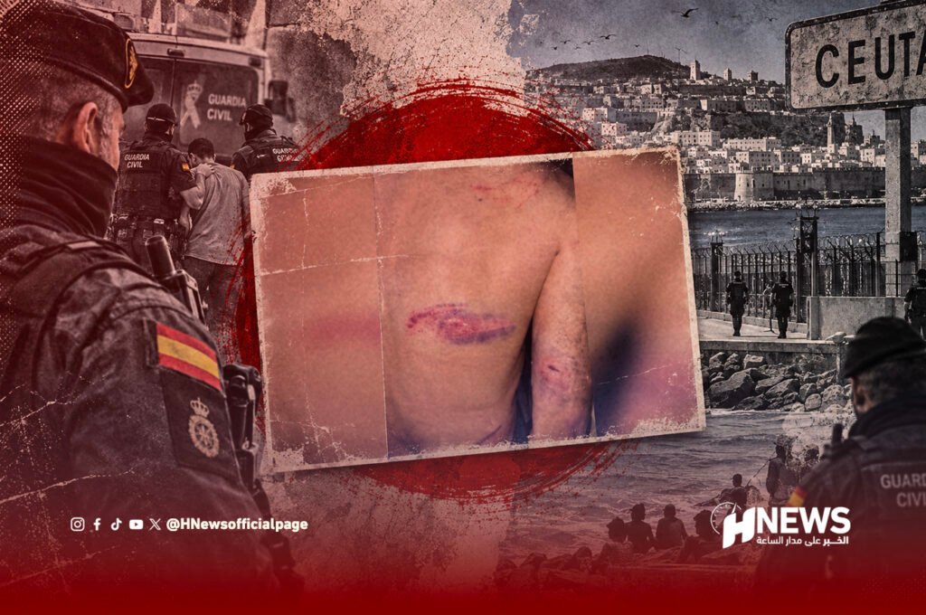 حرق بالسجائر وتهديد بالقتل.. مغربي يروي تفاصيل اعتداء مزعوم في سبتة
